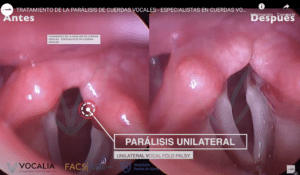 Otorrinolaringólogo especialista en Cuerdas Vocales, Laringología y Trastornos de la Voz.